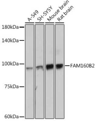 Western Blot: RAI16 AntibodyAzide and BSA Free [NBP3-15604]