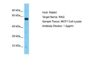 Western Blot: RAI2 Antibody [NBP2-85591]