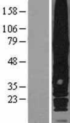 Western Blot: GPRC5A/RAI3 Overexpression Lysate [NBL1-11303]