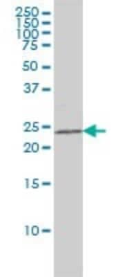 Western Blot: RAIDD/CRADD Antibody (1F8) [H00008738-M01]