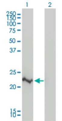 Western Blot: RAIDD/CRADD Antibody (1F8) [H00008738-M01]