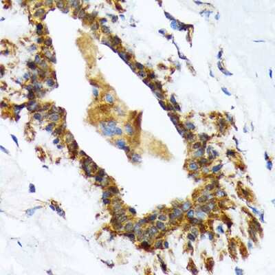 Immunohistochemistry-Paraffin: RAIDD/CRADD Antibody (7M7M6) [NBP3-16673]