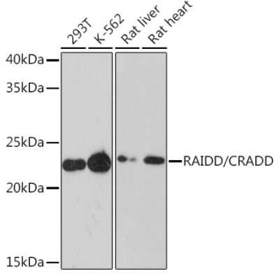 Western Blot: RAIDD/CRADD Antibody (7M7M6) [NBP3-16673]