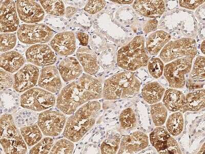 Immunohistochemistry-Paraffin: RAIDD/CRADD Antibody [NBP3-00051]