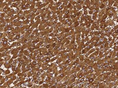 Immunohistochemistry-Paraffin: RAIDD/CRADD Antibody [NBP3-00051]