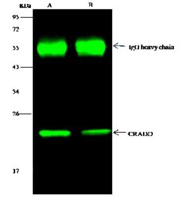 Immunoprecipitation: RAIDD/CRADD Antibody [NBP3-00051]