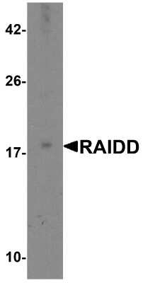 Western Blot: RAIDD/CRADD AntibodyBSA Free [NBP1-77048]