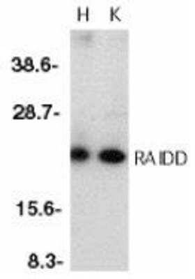 Western Blot: RAIDD/CRADD AntibodyBSA Free [NBP1-77061]