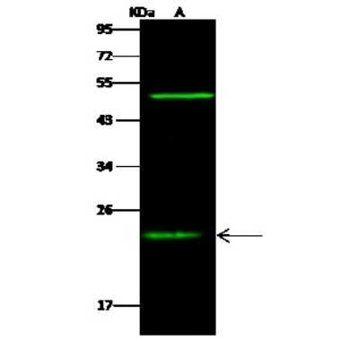 Western Blot: RAIDD/CRADD Antibody [NBP3-00051]