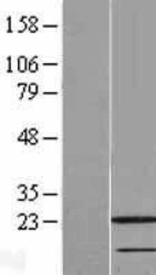 Western Blot: RAIDD/CRADD Overexpression Lysate [NBL1-09459]