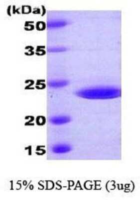 SDS-PAGE: Recombinant Human RAIDD/CRADD His Protein [NBC1-18519]