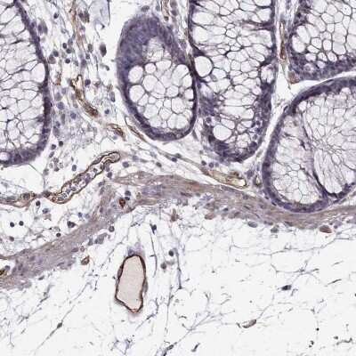 Immunohistochemistry: RAIN Antibody [NBP2-69033]