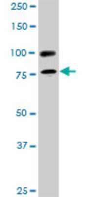 Western Blot: RALBP1 Antibody (2A1) [H00010928-M02]