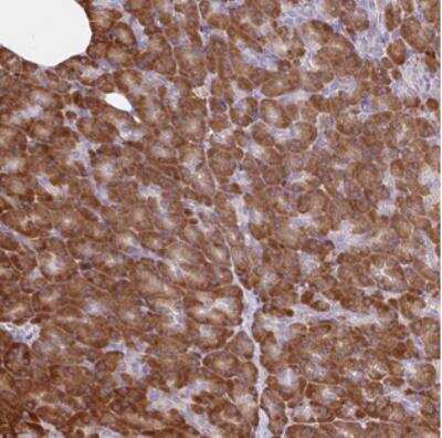 Immunohistochemistry-Paraffin: RALBP1 Antibody [NBP2-30698]