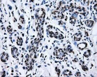 Immunohistochemistry: RALBP1 Antibody (OTI11B2) - Azide and BSA Free [NBP2-73788]