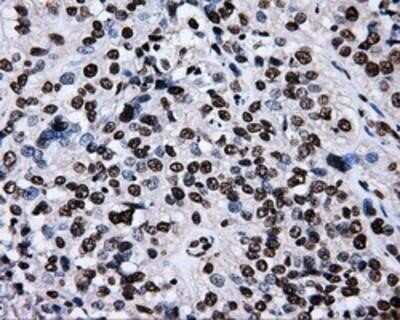 Immunohistochemistry: RALBP1 Antibody (OTI11B2) - Azide and BSA Free [NBP2-73788]