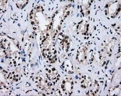 Immunohistochemistry: RALBP1 Antibody (OTI11B2) - Azide and BSA Free [NBP2-73788]