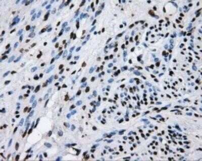 Immunohistochemistry: RALBP1 Antibody (OTI11B2) - Azide and BSA Free [NBP2-73788]