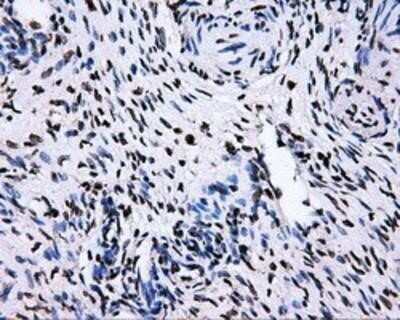 Immunohistochemistry: RALBP1 Antibody (OTI11B2) - Azide and BSA Free [NBP2-73788]