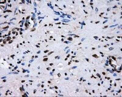 Immunohistochemistry: RALBP1 Antibody (OTI11B2) - Azide and BSA Free [NBP2-73788]