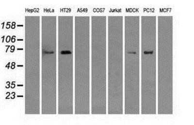 Western Blot: RALBP1 Antibody (OTI11B2)Azide and BSA Free [NBP2-73788]