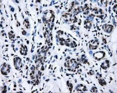 Immunohistochemistry-Paraffin: RALBP1 Antibody (OTI11B2) [NBP2-02293]