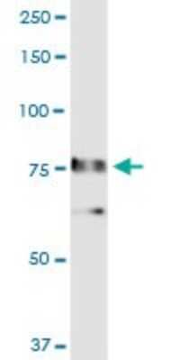 Western Blot: RALBP1 Antibody [H00010928-D01P]