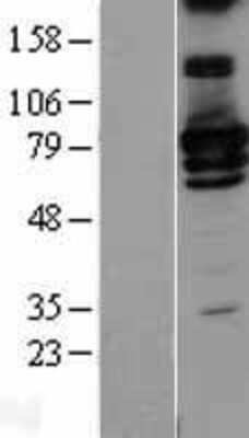 Western Blot: RALBP1 Overexpression Lysate [NBL1-15132]