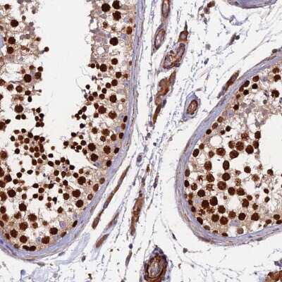 Immunohistochemistry-Paraffin: RALGAPA2 Antibody [NBP2-33399]