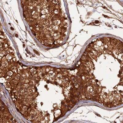 Immunohistochemistry-Paraffin: RALGAPA2 Antibody [NBP2-34082]