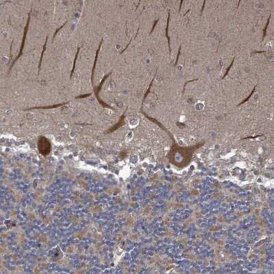 Immunohistochemistry-Paraffin: RALGAPB Antibody [NBP2-14738]
