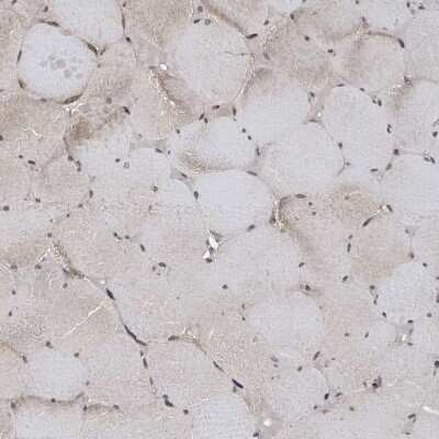 Immunohistochemistry-Paraffin: RALGAPB Antibody [NBP2-14738]