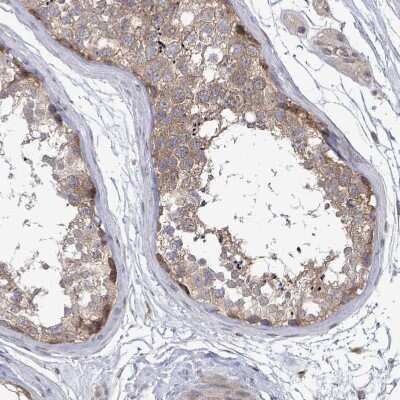 Immunohistochemistry-Paraffin: RALGAPB Antibody [NBP2-14738]