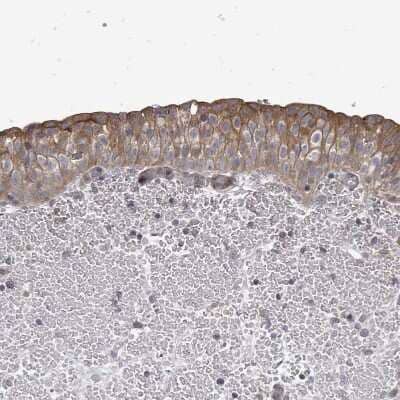 Immunohistochemistry-Paraffin: RALGAPB Antibody [NBP2-14738]