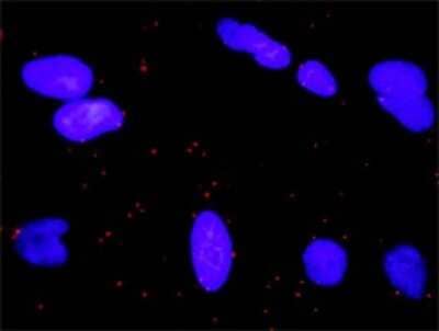 Proximity Ligation Assay: RALGDS Antibody (1A11) [H00005900-M01]