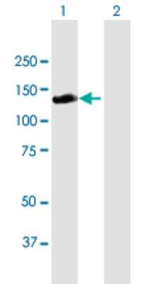 Western Blot: RALGDS Antibody [H00005900-B01P]