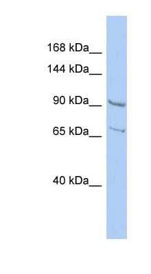 Western Blot: RALGDS Antibody [NBP1-56832]