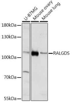 Western Blot: RALGDS AntibodyAzide and BSA Free [NBP2-93790]