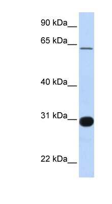 Western Blot: RALGPS1 Antibody [NBP1-58314]