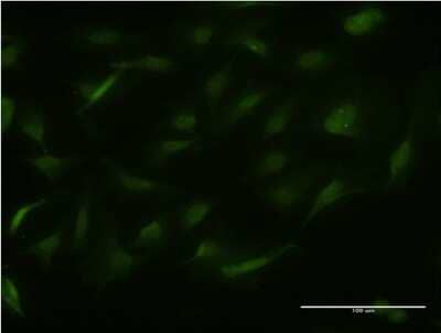 Immunocytochemistry/ Immunofluorescence: RALGPS2 Antibody (1A5) [H00055103-M03]