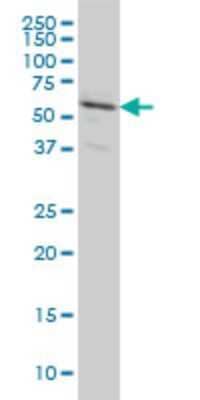 Western Blot: RALGPS2 Antibody (3F1) [H00055103-M01]