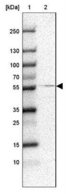 Western Blot: RALGPS2 Antibody [NBP1-84646]