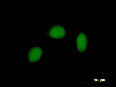 Immunocytochemistry/ Immunofluorescence: RALY Antibody [H00022913-B01P]