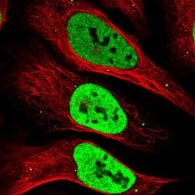 Immunocytochemistry/ Immunofluorescence: RALY Antibody [NBP2-13200]