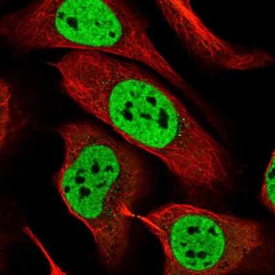 Immunocytochemistry/ Immunofluorescence: RALY Antibody [NBP2-13201]