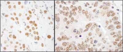 Immunohistochemistry: RALY Antibody [NBP1-19111]