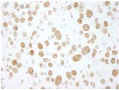 Immunohistochemistry-Paraffin: RALY Antibody [NBP1-19111]