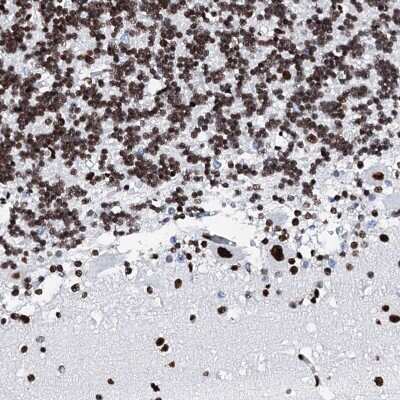 Immunohistochemistry-Paraffin: RALY Antibody [NBP2-13200]
