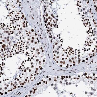 Immunohistochemistry-Paraffin: RALY Antibody [NBP2-13200]