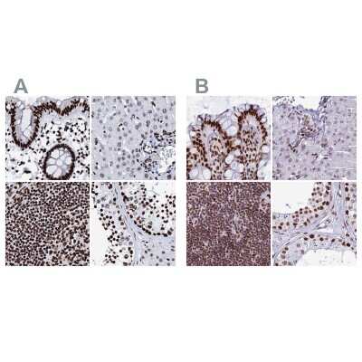 Immunohistochemistry-Paraffin: RALY Antibody [NBP2-13200]
